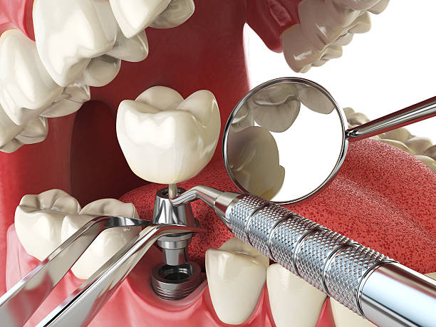 Best Emergency Root Canal Treatment in Liberty, PA